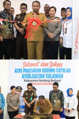 Cathlab, Perkuat Layanan Jantung dan Pembuluh Darah di Sergai