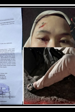 Begal Gunakan Sajam Terjadi di Lau Dendang Honda Beat BK 2737 ANK Raib